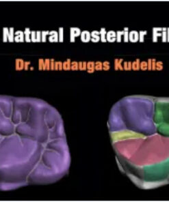 Fast Natural Posterior Fillings