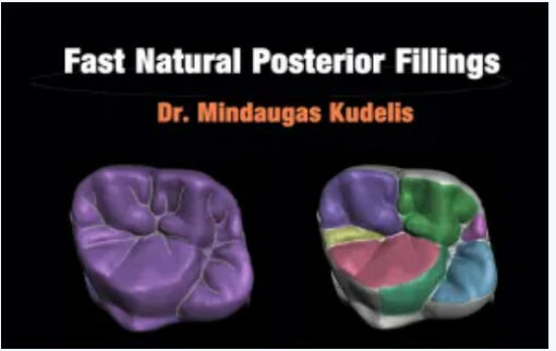 Fast Natural Posterior Fillings