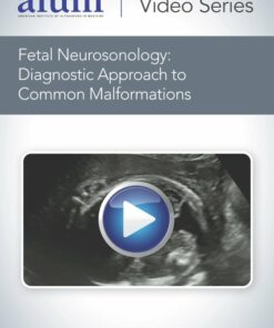 Fetal Neurosonology: Diagnostic Approach to Common Malformations