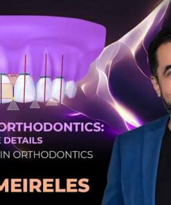 OHI-S  Finishing in orthodontics: aesthetics in the details - Kleber Meireles