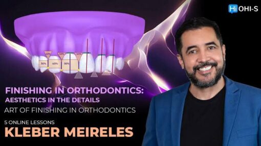 OHI-S  Finishing in orthodontics: aesthetics in the details - Kleber Meireles