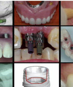 Gidedental A-Z in Restorative Implant Dentistry (CME VIDEOS)