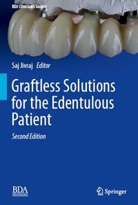 Graftless Solutions for the Edentulous Patient, 2nd Edition