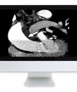 Highlights in Thoracic and Cardiovascular Imaging