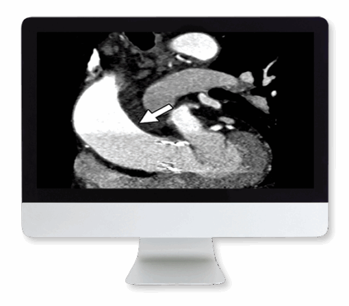 Highlights in Thoracic and Cardiovascular Imaging