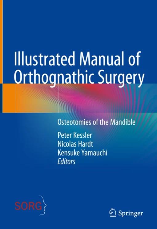 Illustrated Manual of Orthognathic Surgery Osteotomies of the Mandible