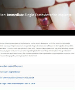 Classic Collection: Immediate Single Tooth Anterior Implants