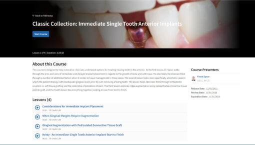 Classic Collection: Immediate Single Tooth Anterior Implants