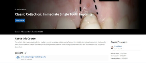 Classic Collection: Immediate Single Tooth Implants