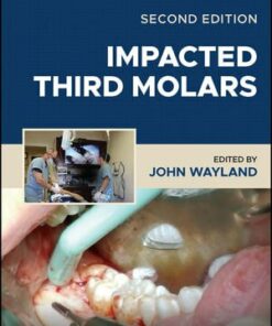 Impacted Third Molars, 2nd Edition pdf