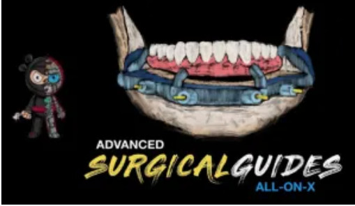 Implant Ninja, Advanced Surgical Guides – All on X