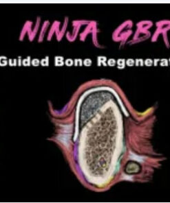 Implant Ninja, Guided Bone Regeneration