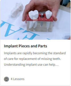 Implant Pieces and Parts