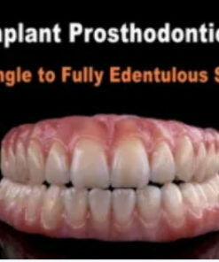 Implant Prosthodontics – From Single to Fully Edentulous Solutions