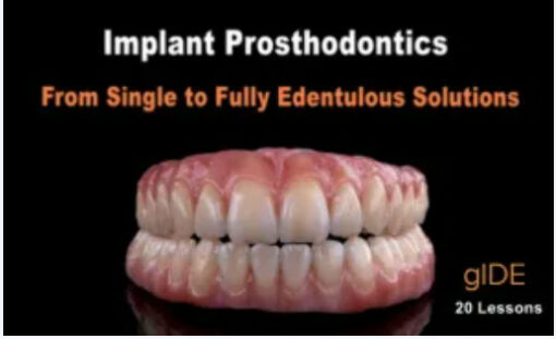 Implant Prosthodontics – From Single to Fully Edentulous Solutions