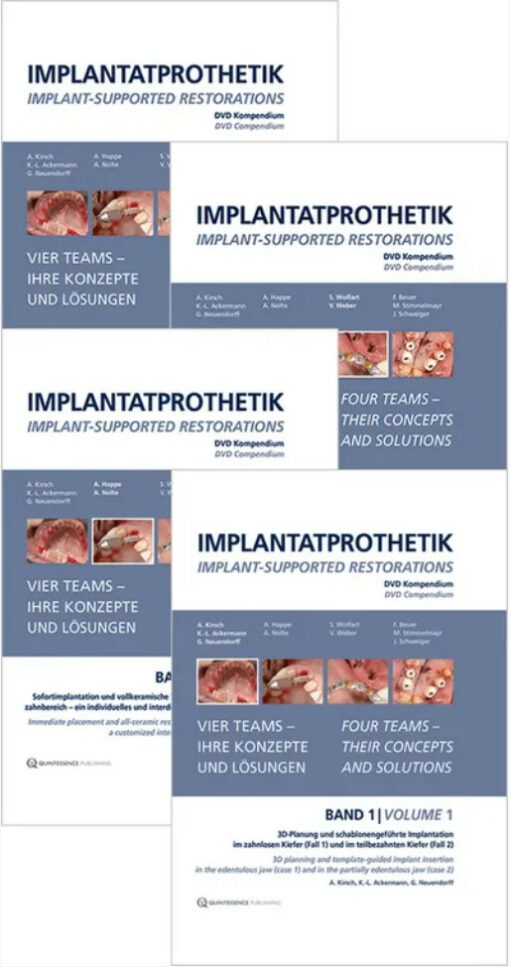 Implant-Supported Restorations – Vol. 1- 4 – (Video Course)