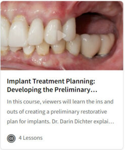 Implant Treatment Planning: Developing the Preliminary Restorative Plan