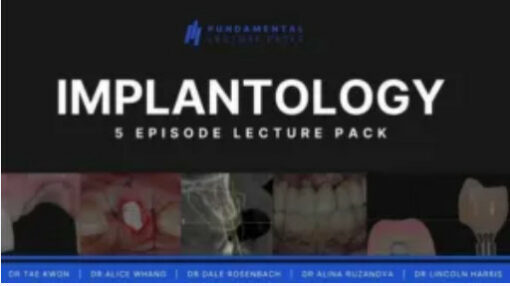Implantology: 5 Episode Lecture Pack
