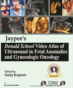 Jaypee's Donald School Video Atlas of Ultrasound in Fetal Anomalies and Gynecologic Oncology