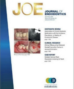 Journal of Endodontics, Full Archive (2007 – 2022) Original PDF
