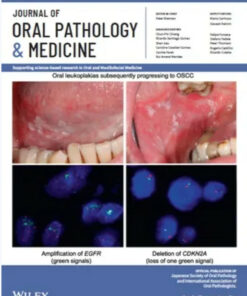 Journal of Oral Pathology and Medicine, Full Archive (2015 – 2022)