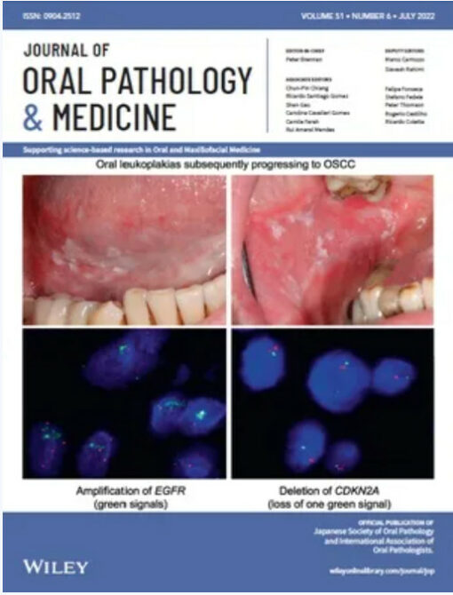 Journal of Oral Pathology and Medicine, Full Archive (2015 – 2022)