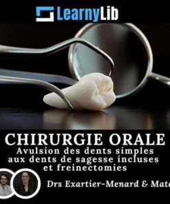 LearnyLib Chirurgie Orale - Exartier-Menard, Mateu Avulsion des dents simples aux dents de sagesse incluses et freinectomies (Francais)