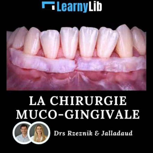 LearnyLib La Chirurgie Muco-Gingivale - Rzeznik & Jalladaud