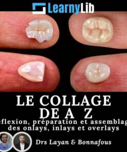 LearnyLib Le Collage de A - Z - Layan, Bonnafous  Reflexion, Preparation et Assemblage des onlays, inlays et overlays (Francais)