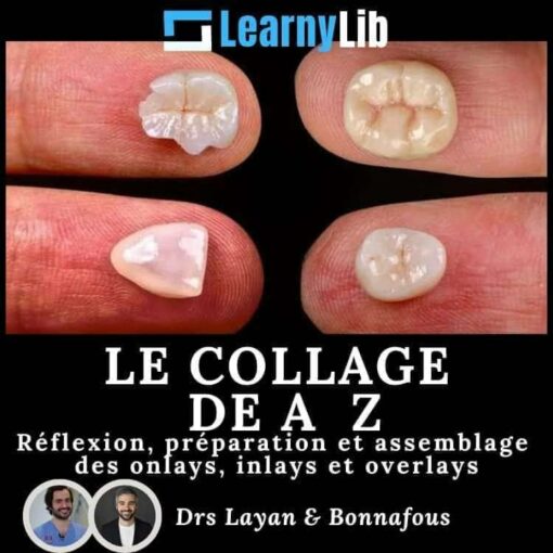 LearnyLib Le Collage de A - Z - Layan, Bonnafous  Reflexion, Preparation et Assemblage des onlays, inlays et overlays (Francais)