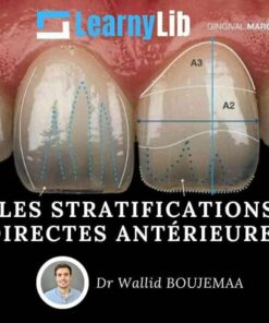 LearnyLib Les Stratifications Directes Anterieures - Ahmed Rabiey - Wallid Boujemaa