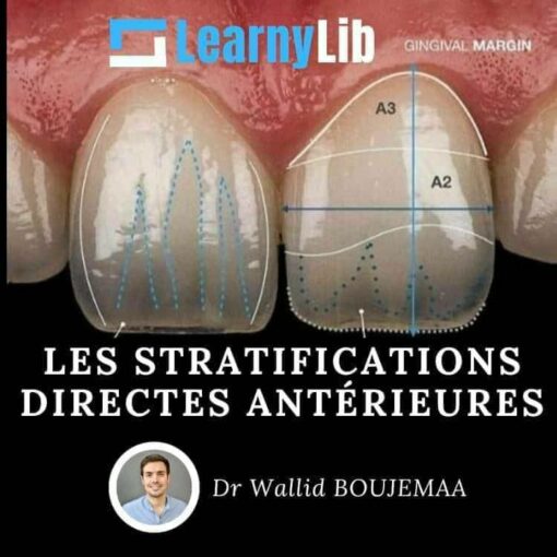 LearnyLib Les Stratifications Directes Anterieures - Ahmed Rabiey - Wallid Boujemaa