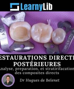 LearnyLib Restaurations Directes Postérieures - Hugues de Belenet Analyse, Preperetion, et Stratirifacation des Composites Directs (Francais)