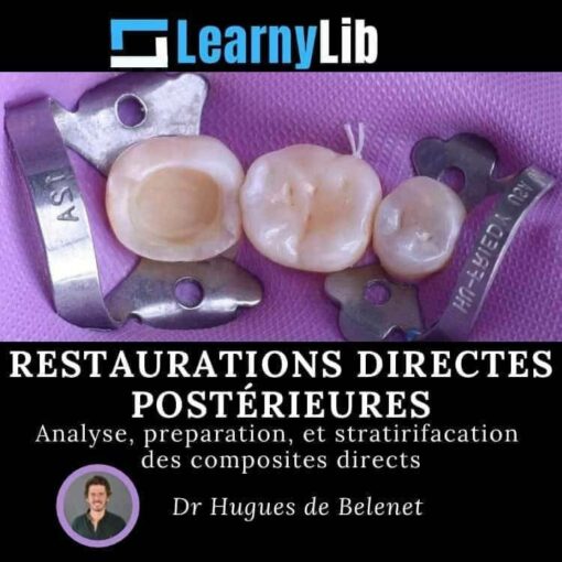 LearnyLib Restaurations Directes Postérieures - Hugues de Belenet Analyse, Preperetion, et Stratirifacation des Composites Directs (Francais)