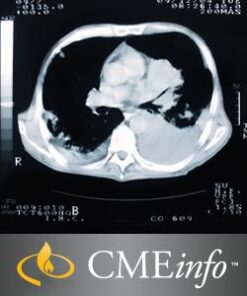 Lung Cancer Imaging 2016 – Videos + PDF