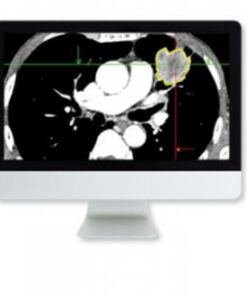 Lung Cancer Screening: A Practical Approach Online Course
