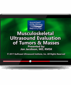 MSK Ultrasound Evaluation of Tumors and Masses