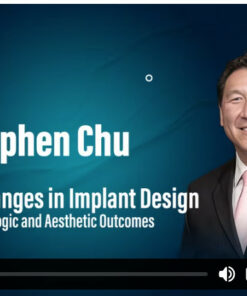 Macro Changes in Implant Design