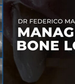 Managing Bone Loss (2 Lectures) Dr. Federico Mandelli