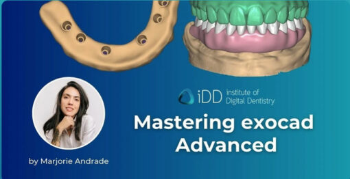 Mastering exocad Advanced - iDD Mastering Exocad Bundle – Marjorie Andreade   