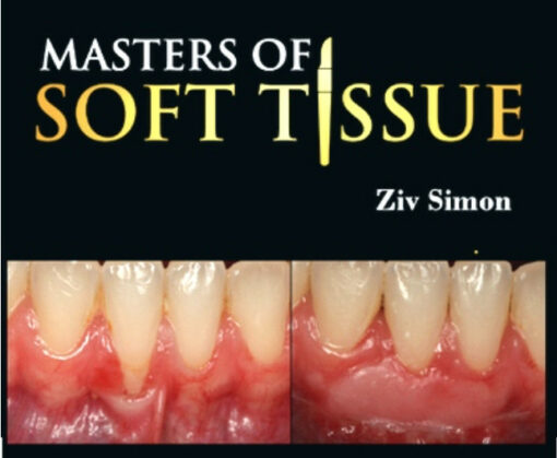 Masters of Soft Tissue – Ziv Simon