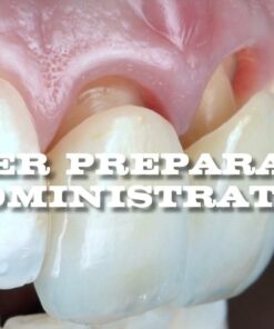 Mastery Academy Veneer Preparation and Administration - Anas Aloum