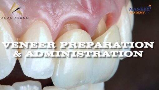 Mastery Academy Veneer Preparation and Administration - Anas Aloum