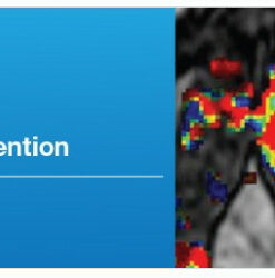 Multi-Parametric Prostate MRI and MR-Guided Intervention - A Video CME Teaching Activity
