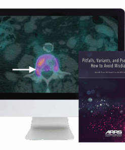 Pitfalls, Variants, and Pseudolesions: How to Avoid Misdiagnosis