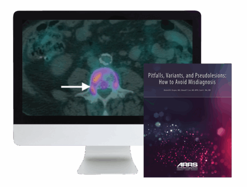 Pitfalls, Variants, and Pseudolesions: How to Avoid Misdiagnosis