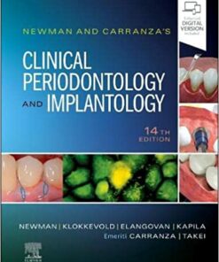 Newman and Carranza's Clinical Periodontology and Implantology 14th Edition