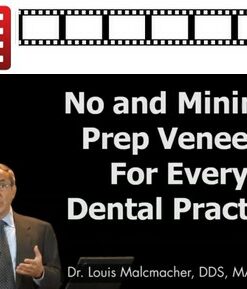 No and Minimal Prep Veneers for Every Dental Practice