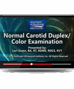 Normal Carotid Duplex/Color Examination