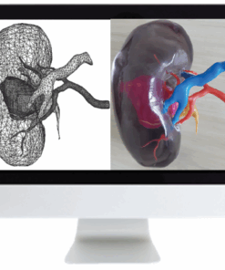 3D Printing of Anatomic Models: Value Added Opportunity for Radiology